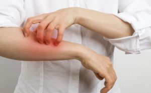 Pourquoi rêver de gale ?