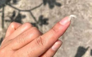 Pourquoi rêver d'ongle tombé ?