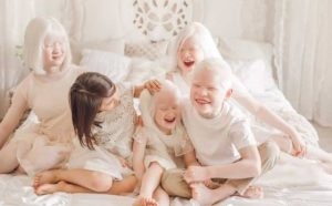 Pourquoi rêver d'albinos ?