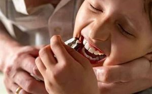 Pourquoi rêver d'arracher une dent ?