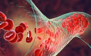 Pourquoi rêver d'artère veineuse ?