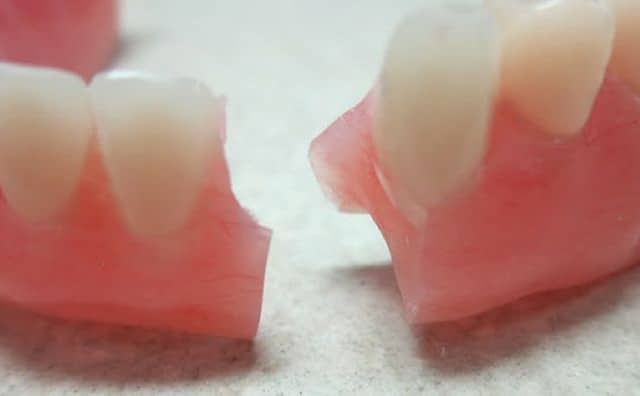 Pourquoi rêver de dentier cassé en deux?