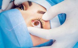 Pourquoi rêver de se faire opérer des yeux ?