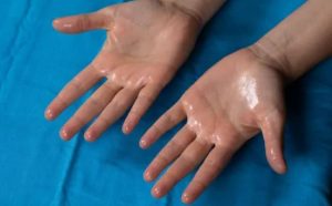 Pourquoi rêver de mains moites ?