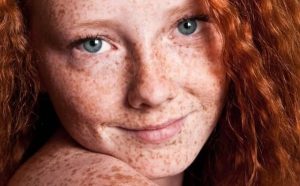 Pourquoi rêver de taches de rousseur sur un visage ?