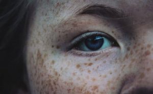 Pourquoi rêver de taches de rousseur ?