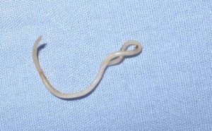 Pourquoi rêver de ténia ?